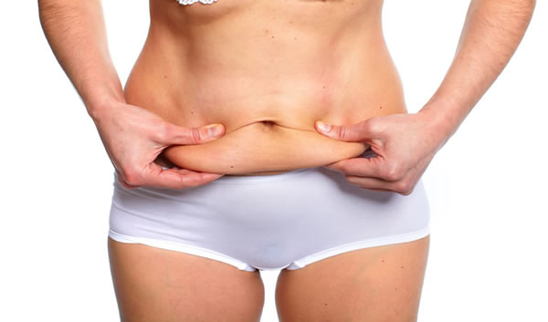 Loose Skin Treated with Tummy Tuck in Los Angeles CA